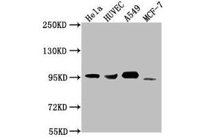 Western Blot Positive WB detected in: Hela whole cell lysate, HUVEC whole cell lysate, A549 whole cell lysate, MCF-7 whole cell lysate All lanes: CD44 antibody at 1:1500 Secondary Goat polyclonal to Mouse IgG at 1/10000 dilution Predicted band size: 82, 4, 78, 77, 81, 79, 75, 54,47, 40, 44, 33, 74, 76, 38, 16 kDa Observed band size: 95 kDa (CD44 antibody  (AA 21-220))