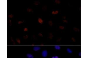 Immunofluorescence analysis of U-2 OS cells using PSME3 Polyclonal Antibody at dilution of 1:100 (40x lens). (PSME3 antibody)