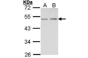 WB Image Sample (30 ug of whole cell lysate) A: A431 , B: H1299 10% SDS PAGE antibody diluted at 1:1000 (EDNRB antibody  (N-Term))