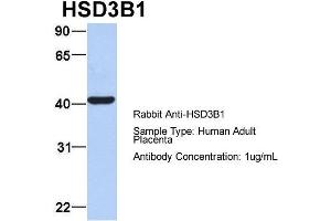 Host: Rabbit Target Name: HSD3B1 Sample Type: Human Adult Placenta Antibody Dilution: 1. (HSD3B1 antibody  (N-Term))