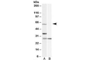 Western blot testing of HeLa cell lysate with PRPF31 antibody at 1ug/ml with [B] and without [A] blocking/immunizing peptide. (PRPF31 antibody)
