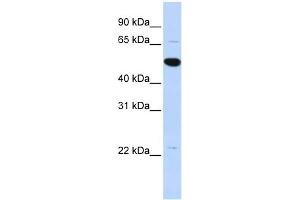WB Suggested Anti-RP13-102H20. (ARHGAP36 antibody  (Middle Region))