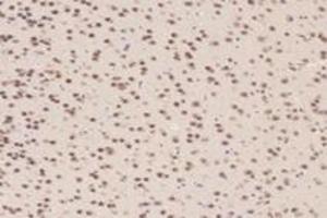Immunohistochemistry analysis of paraffin-embedded mouse prefrontal lobe using TCOF1 (ABIN7076003) at dilution of 1: 2800