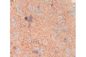 IHC-P analysis of Rat Tissue, with DAB staining. (DSTYK antibody  (AA 650-904))