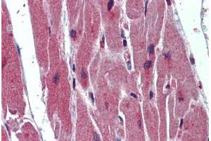 Human Heart: Formalin-Fixed, Paraffin-Embedded (FFPE) (SRSF11 antibody  (AA 398-447))