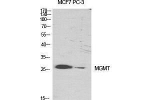 Western Blot (WB) analysis of specific cells using MGMT Polyclonal Antibody.