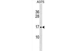 Western Blotting (WB) image for anti-Signal Recognition Particle 14kDa (Homologous Alu RNA Binding Protein) (SRP14) antibody (ABIN3000684)