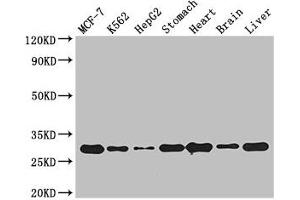 Western Blot Positive WB detected in: MCF-7 whole cell lysate, K562 whole cell lysate, HepG2 whole cell lysate, Mouse stomach tissue, Mouse heart tissue, Mouse brain tissue, Mouse liver tissue All lanes: RABGAP1L antibody at 3 μg/mL Secondary Goat polyclonal to rabbit IgG at 1/50000 dilution Predicted band size: 30, 93, 69, 95, 91, 44, 42, 43, 9 kDa Observed band size: 30 kDa (RABGAP1L antibody  (Isoform 10))