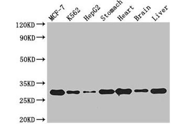 RABGAP1L antibody  (Isoform 10)