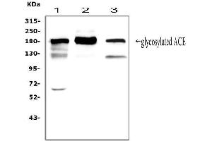 Western blot analysis of ACE using anti-ACE antibody (ABIN3043777). (Angiotensin I Converting Enzyme 1 antibody  (AA 651-864))