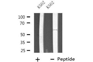 Western blot analysis of extracts from K562 cells, using PTGIS antibody.