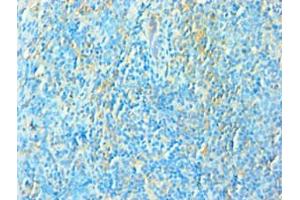 Immunohistochemistry of paraffin-embedded human tonsil tissue using ABIN7172534 at dilution of 1:100 (TFEB antibody  (AA 1-220))