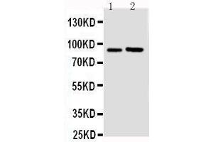 Anti-FGFR3 antibody, Western blotting Lane 1: U87 Cell Lysate Lane 2: SGC Cell Lysate (FGFR3 antibody  (N-Term))