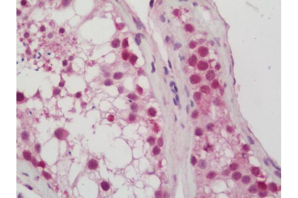 CDKN2AIPNL antibody  (HRP)