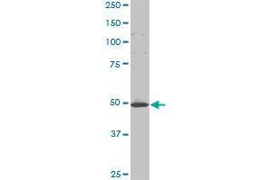HD monoclonal antibody (M11), clone 3F1. (Huntingtin antibody  (AA 81-190))