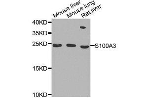 Western blot analysis of extracts of various cell lines, using S100A3 antibody. (S100A3 antibody  (AA 1-101))