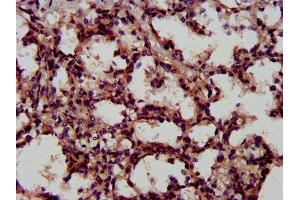 Immunohistochemistry (IHC) image for anti-Leukemia Inhibitory Factor Receptor alpha (LIFR) (AA 915-1086) antibody (ABIN7158226)