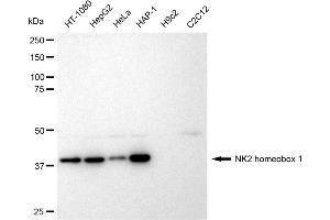 anti-NK2 Homeobox 1 (NKX2-1) antibody