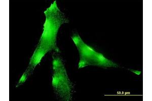 Immunofluorescence of monoclonal antibody to EVL on HeLa cell. (EVL antibody  (AA 309-418))