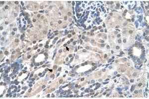 Human kidney (PIGV antibody  (N-Term))