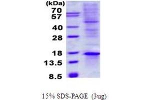 Image no. 1 for TGFB1-Induced Anti-Apoptotic Factor 1 (TIAF1) protein (His tag) (ABIN1098676)