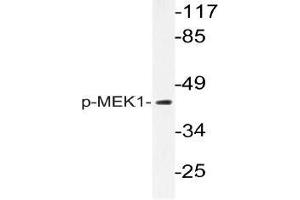 Western blot (WB) analysis of p-MEK1 antibody in extracts from K562 cells. (MEK1 antibody  (pThr292))