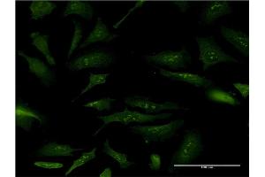 Immunofluorescence of monoclonal antibody to NPM2 on HeLa cell. (NPM2 antibody  (AA 1-214))