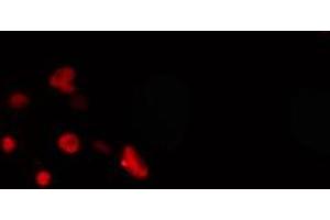 ABIN6274269 staining COLO205 cells by IF/ICC. (MEOX2 antibody  (Internal Region))