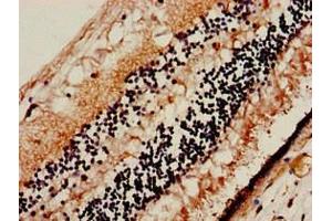 Immunohistochemistry of paraffin-embedded human eye tissue using ABIN7175498 at dilution of 1:100 (SLC32A1 antibody  (AA 14-118))