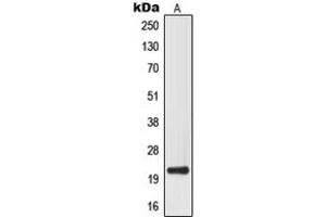 Western blot analysis of MRPL32 expression in HepG2 (A) whole cell lysates. (MRPL32 antibody  (Center))