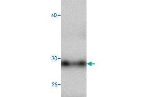 Western blot analysis in CCL5 recombinant protein with CCL5 monoclonal antibody, clone 8f64  at 1 : 1000 dilution. (CCL5 antibody)