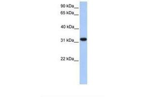 Image no. 1 for anti-Electron-Transfer-Flavoprotein, alpha Polypeptide (ETFA) (N-Term) antibody (ABIN6738925) (ETFA antibody  (N-Term))