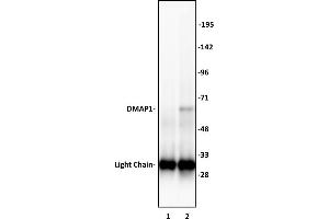 DMAP1 antibody (pAb) tested by Immunoprecipitation. (DMAP1 antibody  (C-Term))
