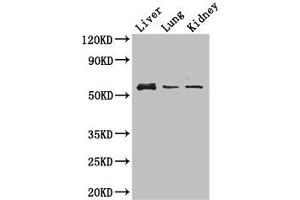 Western Blot Positive WB detected in: Mouse liver tissue, Mouse lung tissue, Mouse kidney tissue All lanes: MMP8 antibody at 3 μg/mL Secondary Goat polyclonal to rabbit IgG at 1/50000 dilution Predicted band size: 54 kDa Observed band size: 54 kDa (MMP8 antibody  (AA 22-283))