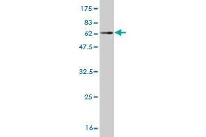 Western Blot detection against Immunogen (60. (JMJD7-PLA2G4B antibody  (AA 1-316))