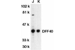 Western blot analysis of DFF40 in Jurkat (J) and K562 (K) whole cell lysate with AP30287PU-N DFF40 antibody at 1/500 dilution. (DFFB antibody  (N-Term))