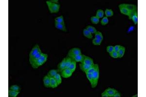 Immunofluorescent analysis of HepG2 cells using ABIN7167907 at dilution of 1:100 and Alexa Fluor 488-congugated AffiniPure Goat Anti-Rabbit IgG(H+L) (ARHGDIB antibody  (AA 2-86))