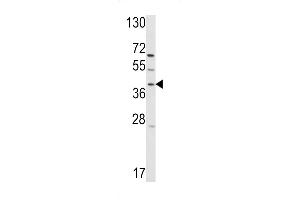 Western blot analysis of hRai3- (ABIN390176 and ABIN2840668) in T47D cell line lysates (35 μg/lane). (GPRC5A antibody  (C-Term))