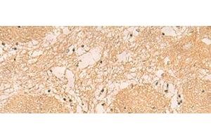 Immunohistochemistry of paraffin-embedded Human brain tissue using EMC1 Polyclonal Antibody at dilution of 1:40(x200) (KIAA0090 antibody)
