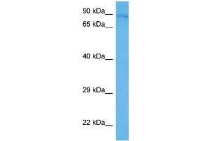Host:  Mouse  Target Name:  HNRNPU  Sample Tissue:  Mouse Liver  Antibody Dilution:  1ug/ml (HNRNPU antibody  (N-Term))