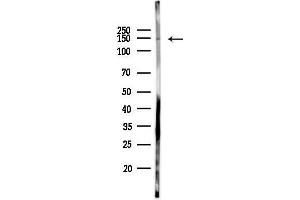 Western blot analysis of lysates from Hela cells(starvation 24h treatment), using RI2 Antibody at 1/1000 dilution.