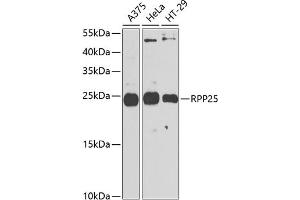 Western blot analysis of extracts of various cell lines, using RPP25 antibody (ABIN6133248, ABIN6147176, ABIN6147177 and ABIN6225317) at 1:1000 dilution. (RPP25 antibody  (AA 1-199))