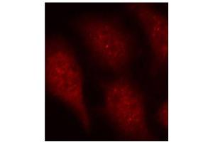 Immunofluorescence staining of methanol-fixed HeLa cells using Phospho-CDK6-Y24 antibody (ABIN2987839). (CDK6 antibody  (pTyr24))