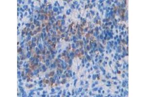 IHC-P analysis of Kidney tissue, with DAB staining. (VAV1 antibody  (AA 565-795))