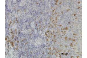 Immunoperoxidase of monoclonal antibody to SSR1 on formalin-fixed paraffin-embedded human tonsil. (SSR1 antibody  (AA 33-286))