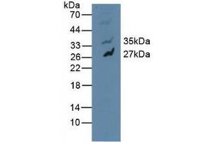 Figure. (MAPK10 antibody  (AA 88-332))