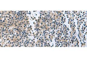 Immunohistochemistry of paraffin-embedded Human tonsil tissue using RGS2 Polyclonal Antibody at dilution of 1:95(x200) (RGS2 antibody)