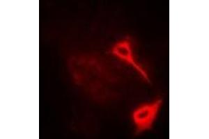 Immunofluorescent analysis of HAS3 staining in A549 cells. (HAS3 antibody)