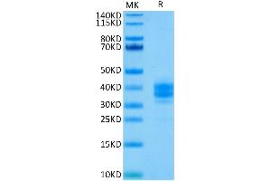 EpCAM Protein (AA 24-265) (His tag)