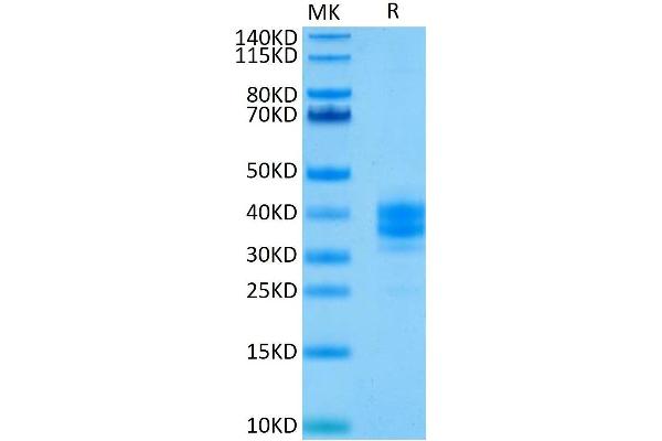 EpCAM Protein (AA 24-265) (His tag)